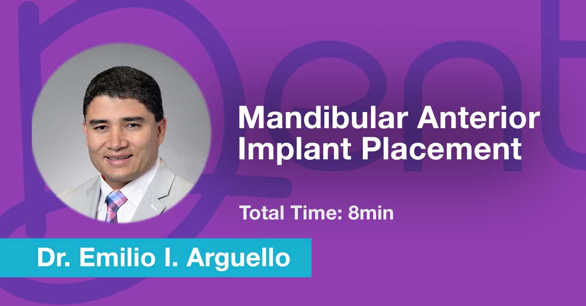 Mandibular Anterior Implant Placement